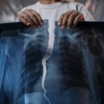 A child holds a torn X-ray image, highlighting healthcare themes.